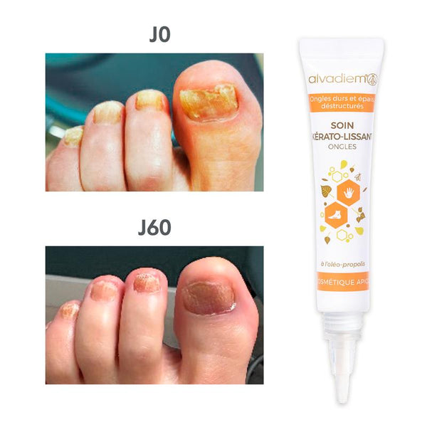 Soin Kérato-Lissant Ongles - 30ml