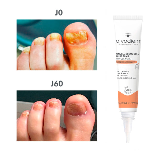 Soin Kérato-Lissant Ongles - 30ml