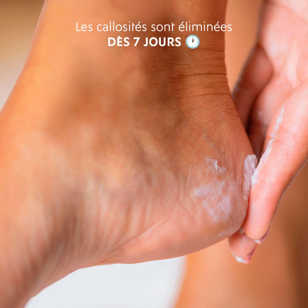 Crème Anti-Callosités - 75ml