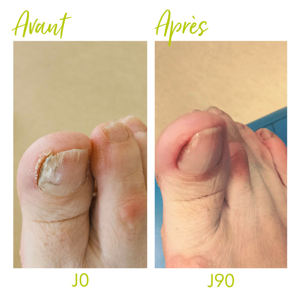 Soin Assainissant - 30ml